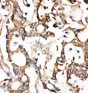 Anti-ALDH2 Rabbit Polyclonal Antibody