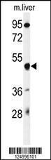 Anti-GSDMA Rabbit Polyclonal Antibody (APC (Allophycocyanin))