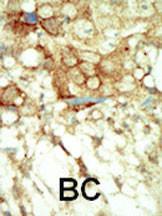 Anti-RET Rabbit Polyclonal Antibody