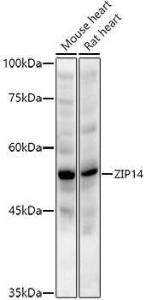 Anti-SLC39A14/ZIP-14 antibody