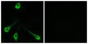 Anti-OR52E4 antibody