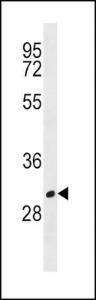 Anti-MS4A1 Rabbit Polyclonal Antibody (APC (Allophycocyanin))