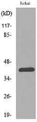 Western blot analysis of lysate from Jurkat cells using Anti-SERPINB3 + SERPINB4 Antibody