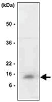 Anti-MIF Mouse Monoclonal Antibody [clone: 4E4]