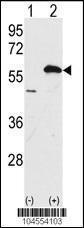 Anti-UBQLN1 Rabbit Polyclonal Antibody (AP (Alkaline Phosphatase))