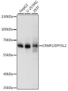 Western blot analysis of extracts of various cell lines, using Anti-CRMP2 Antibody (A92997) at 1:1,000 dilution. The secondary antibody was Goat Anti-Rabbit IgG H&L Antibody (HRP) at 1:10,000 dilution.