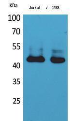 Western blot analysis of Jurkat, 293 cells using Anti-SERPINB3 + SERPINB4 Antibody