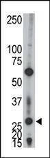 Anti-AK2 Rabbit Polyclonal Antibody (HRP (Horseradish Peroxidase))