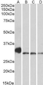 Anti-NEK7 Antibody (A84901) (0.3 µg/ml) staining of Mouse Lung (A), Mouse Testis (B), Rat Lung (C) and Rat Testis (D) lysates (35 µg protein in RIPA buffer). Primary incubation was 1 hour. Detected by chemiluminescence