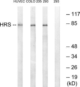 Anti-HGS Rabbit Polyclonal Antibody