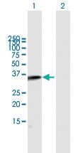 Anti-C2 Mouse Polyclonal Antibody