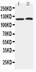 Anti-HDAC5 Rabbit Polyclonal Antibody