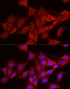 Immunofluorescence analysis of NIH/3T3 cells using Anti-Smg1 Antibody (A307835) at a dilution of 1:200 (40X lens). DAPI was used to stain the cell nuclei (blue)