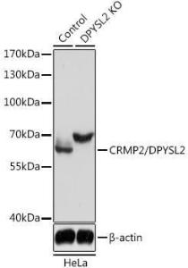 Western blot analysis of extracts from normal (control) and CRMP2/CRMP2/DPYSL2 knockout (KO) HeLa cells, using Anti-CRMP2 Antibody (A92997) at 1:3,000 dilution. The secondary antibody was Goat Anti-Rabbit IgG H&L Antibody (HRP) at 1:10,000 dilution.