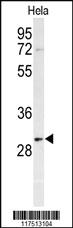 Anti-PHB Rabbit Polyclonal Antibody