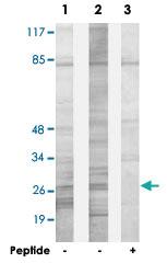 Anti-SPIC Rabbit Polyclonal Antibody