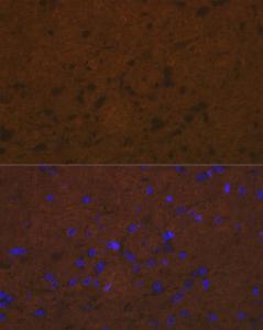 Immunofluorescence analysis of rat brain cells using Anti-Talin 2 Antibody [ARC2335] (A309077) at a dilution of 1:100 (40X lens). DAPI was used to stain the cell nuclei (blue)