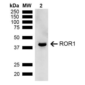 Western blot analysis of rat kidney showing detection of ~43 kDa ROR1 protein using Anti-ROR1 Antibody (A305046) at 1:1,000 for 2 hours at room temperatur