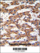 Anti-PHB Rabbit Polyclonal Antibody