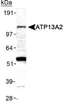 Anti-ATP13A2 Rabbit Polyclonal Antibody