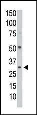 Anti-PPP1CC Rabbit Polyclonal Antibody (AP (Alkaline Phosphatase))