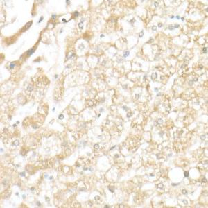 Anti-SLC39A14/ZIP-14 antibody