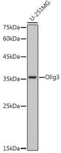 Western blot analysis of extracts of U-251MG cells, using Anti-Olig3 Antibody [ARC2524] (A306166) at 1:1,000 dilution. The secondary antibody was Goat Anti-Rabbit IgG H&L Antibody (HRP) at 1:10,000 dilution.