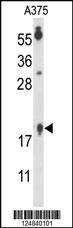 Anti-MYL9 Rabbit Polyclonal Antibody