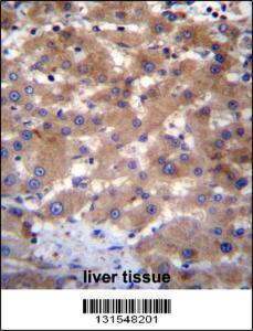 Anti-UBE2NL Rabbit Polyclonal Antibody (HRP (Horseradish Peroxidase))