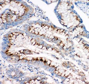 Anti-Mannose 6 Phosphate Receptor (Cation independent) Rabbit Polyclonal Antibody