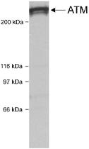 Anti-ATM Rabbit Polyclonal Antibody