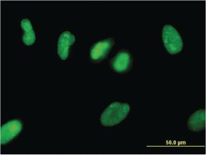 Anti-ZNF101 Mouse Monoclonal Antibody [clone: 2D5]