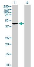 Anti-TBC1D20 Mouse Polyclonal Antibody