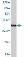 Anti-SLC15A1 Mouse Monoclonal Antibody [clone: 1F8]