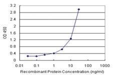 Anti-ALDH3A1 Antibody Pair