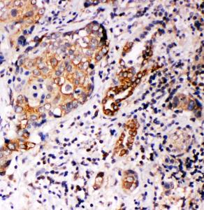 Anti-Annexin A10 Rabbit Polyclonal Antibody