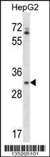 Anti-OR4Q3 Rabbit Polyclonal Antibody (Biotin)