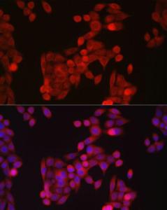 Anti-SLC39A14/ZIP-14 antibody