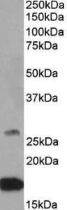 Anti-CNTF Antibody (A84903) (05 µg/ml) staining of Mouse Brain lysate (35 µg protein in RIPA buffer) Primary incubation was 1 hour Detected by chemiluminescence