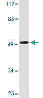 Anti-RAD51C Rabbit Polyclonal Antibody