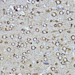 Immunohistochemistry analysis of paraffin-embedded rat brain using Anti-CRMP2 Antibody (A92997) at a dilution of 1:400 (40x lens). Perform high pressure antigen retrieval with 10 mM citrate buffer pH 6.0 before commencing with IHC staining protocol.