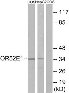 Antibody anti-OR52E1 A99515-100 100 µg