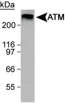 Anti-ATM Rabbit Polyclonal Antibody