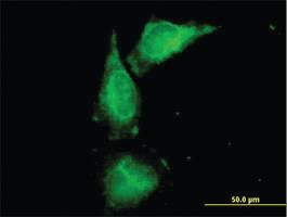 Anti-UMOD Mouse Polyclonal Antibody