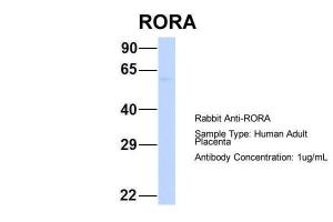 Anti-RORA Rabbit Polyclonal Antibody