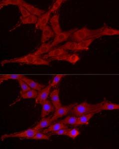 Immunofluorescence analysis of PC-12 cells using Anti-Smg1 Antibody (A307835) at a dilution of 1:200 (40X lens). DAPI was used to stain the cell nuclei (blue)