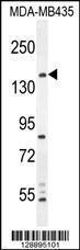 Anti-CAMSAP1 Rabbit Polyclonal Antibody (APC (Allophycocyanin))