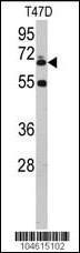 Anti-UBQLN1 Rabbit Polyclonal Antibody (Biotin)