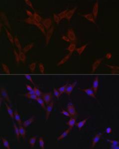 Anti-SLC39A14/ZIP-14 antibody