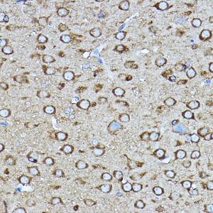 Immunohistochemistry analysis of paraffin-embedded mouse brain using Anti-CRMP2 Antibody (A92997) at a dilution of 1:400 (40x lens). Perform high pressure antigen retrieval with 10 mM citrate buffer pH 6.0 before commencing with IHC staining protocol.